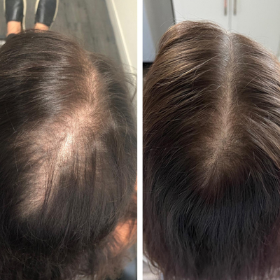 Customer photo